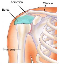 bursitis-shoulder