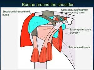 subdeltoid bursitis